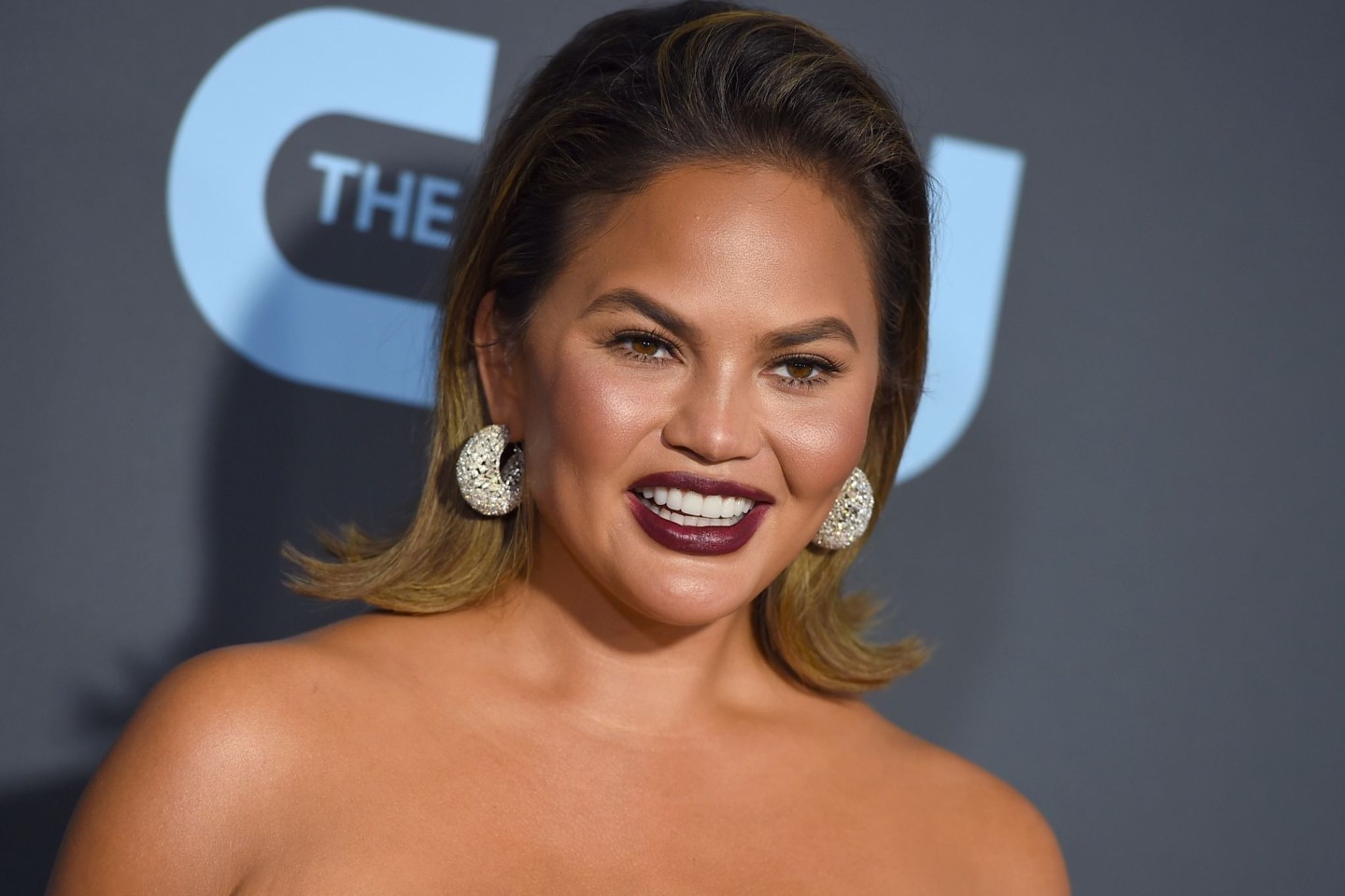 Chrissy Teigen über Buccal Fat Removal: «Ja, ich habe es getan, na und?»